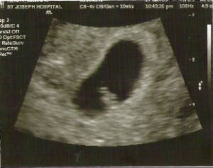fetus.jpg